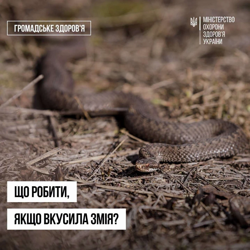 що робити, якщо вкусила змія що робити, якщо вкусила змія